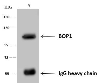 BOP1 Antibody in Immunoprecipitation (IP)