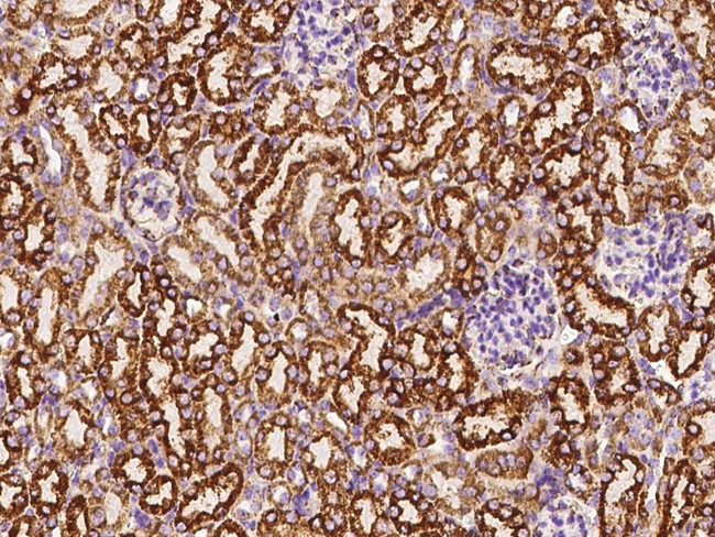 C1QBP Antibody in Immunohistochemistry (Paraffin) (IHC (P))