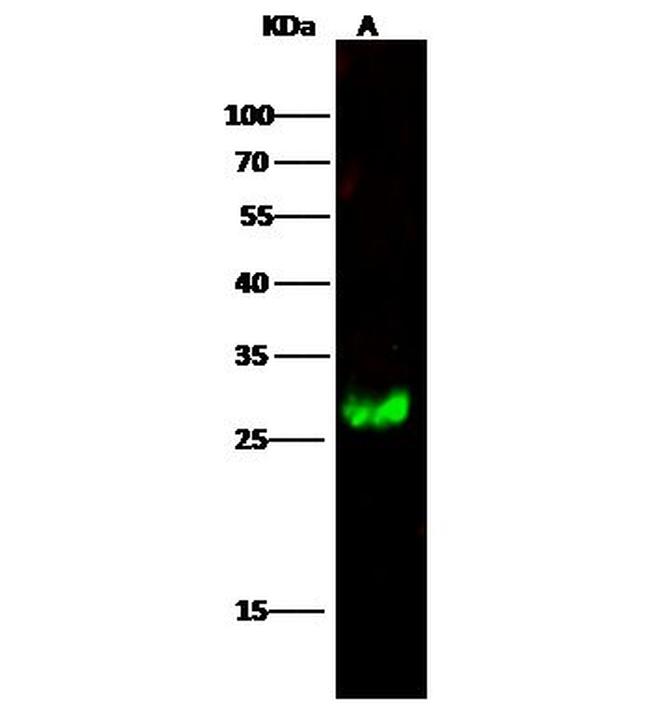 Calbindin Antibody in Western Blot (WB)