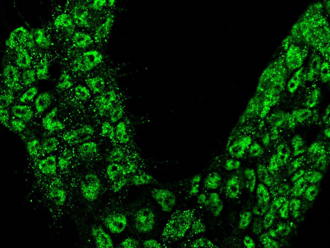 Calbindin Antibody in Immunocytochemistry (ICC/IF)