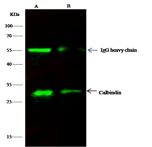 Calbindin Antibody in Immunoprecipitation (IP)