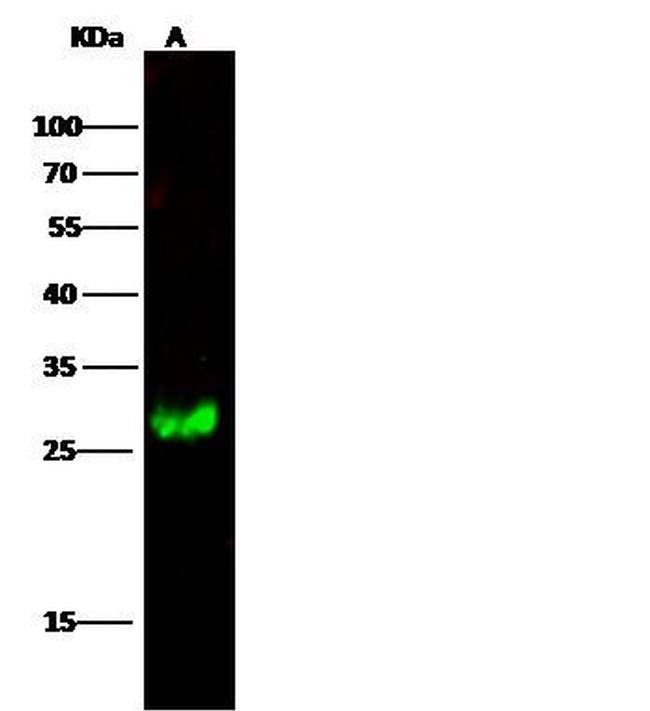 Calbindin Antibody in Western Blot (WB)