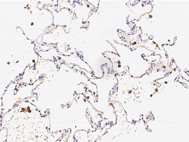 CAPG Antibody in Immunohistochemistry (Paraffin) (IHC (P))