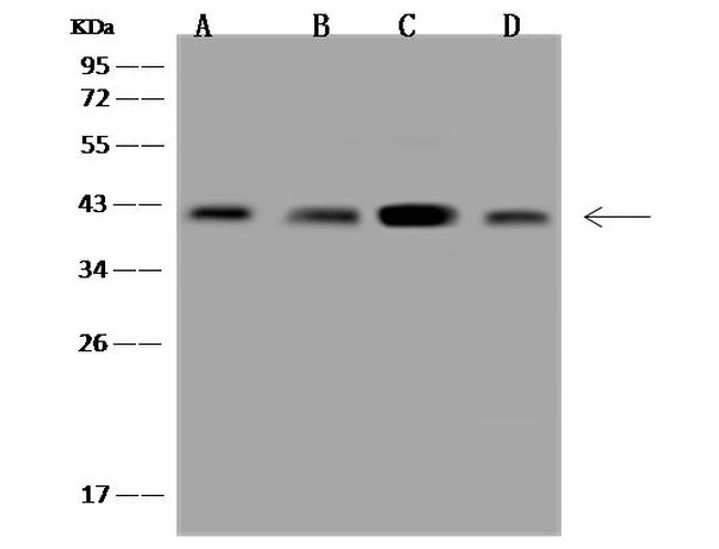 CAPG Antibody in Western Blot (WB)