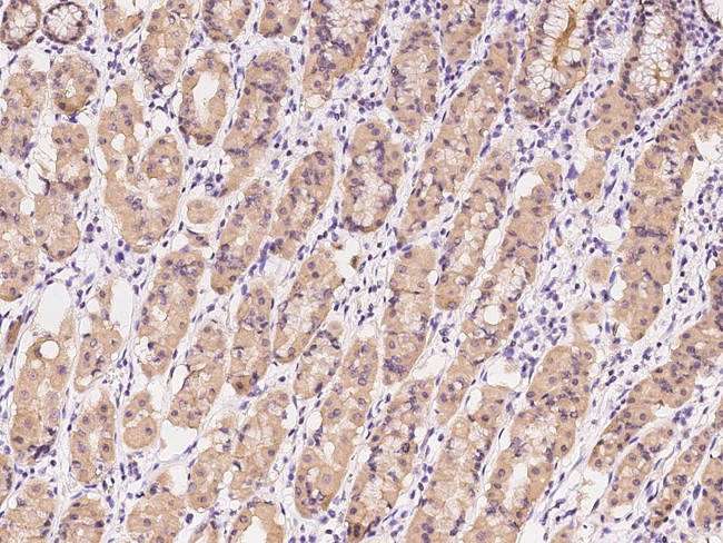 Caspase 7 Antibody in Immunohistochemistry (Paraffin) (IHC (P))