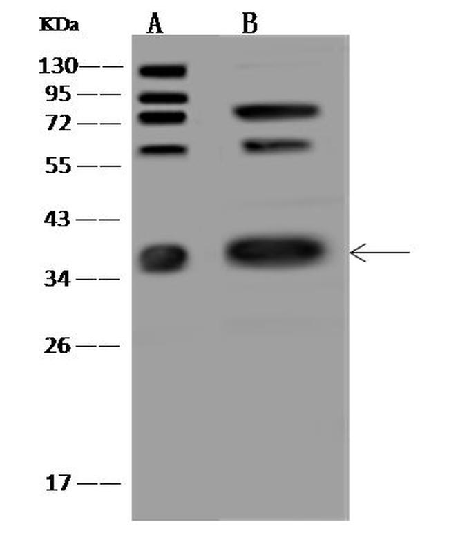 Caspase 7 Antibody in Western Blot (WB)