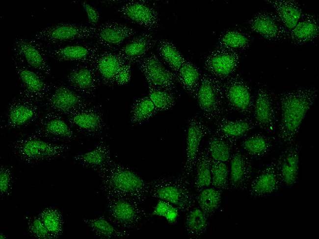 Calsequestrin 2 Antibody in Immunocytochemistry (ICC/IF)