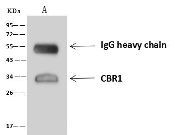 CBR1 Antibody in Immunoprecipitation (IP)