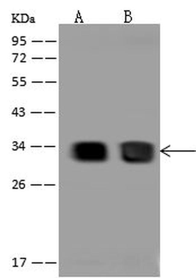 CBR1 Antibody in Western Blot (WB)