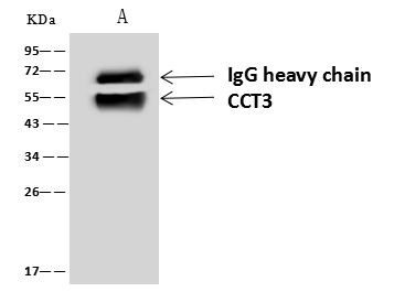 CCT3 Antibody in Immunoprecipitation (IP)