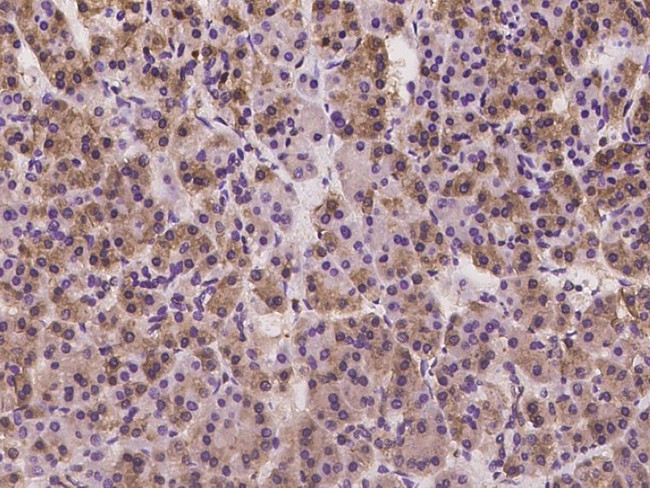 CD2AP Antibody in Immunohistochemistry (Paraffin) (IHC (P))