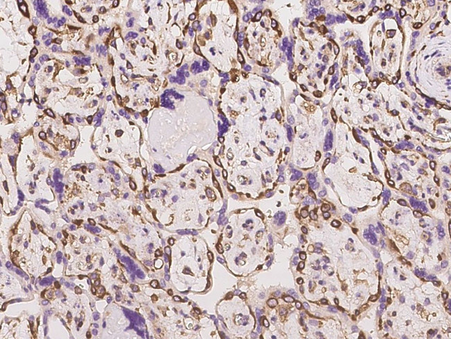 CD2AP Antibody in Immunohistochemistry (Paraffin) (IHC (P))