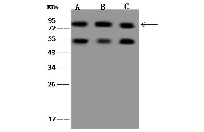 CD2AP Antibody in Western Blot (WB)