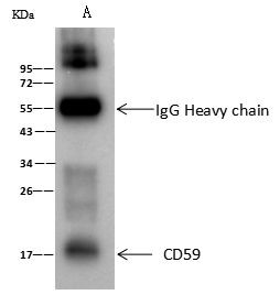 CD59 Antibody in Immunoprecipitation (IP)