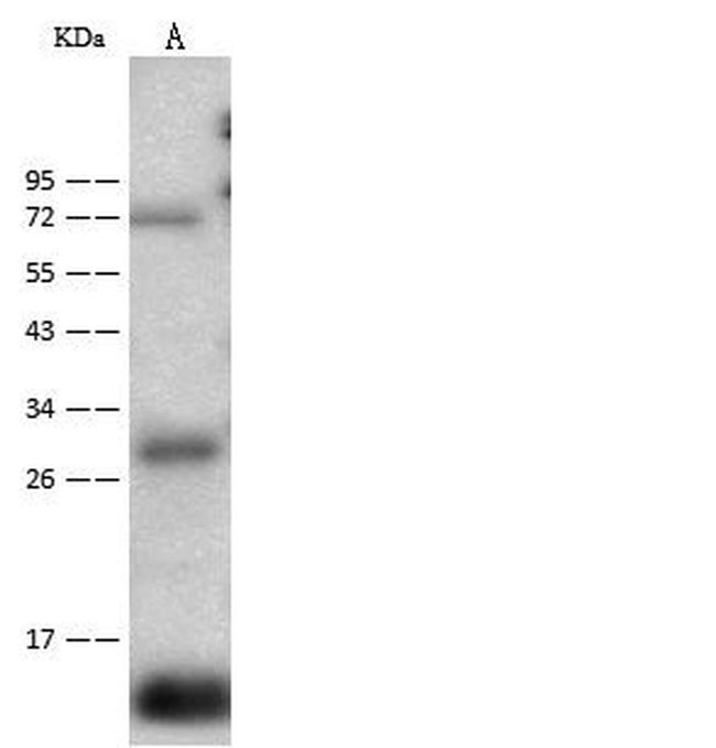 CD59 Antibody in Western Blot (WB)