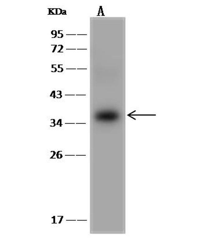 Cdc34 Antibody in Western Blot (WB)