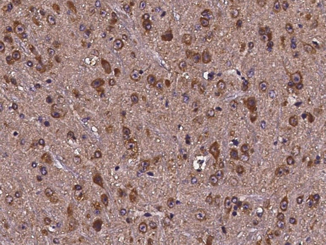 Cdc37 Antibody in Immunohistochemistry (Paraffin) (IHC (P))