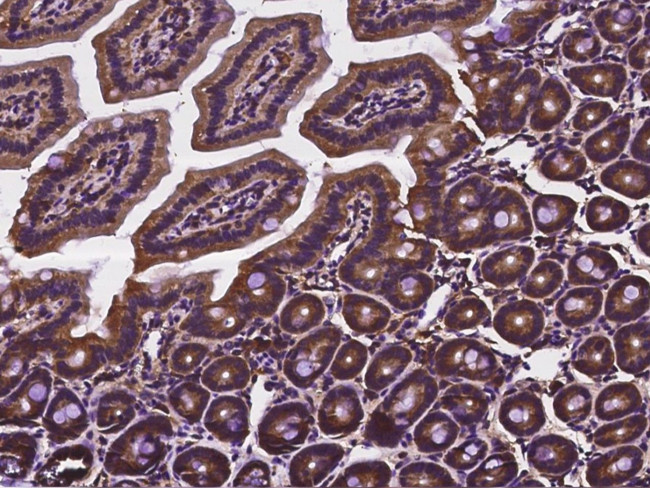 Cdc37 Antibody in Immunohistochemistry (Paraffin) (IHC (P))