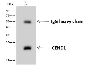 CEND1 Antibody in Immunoprecipitation (IP)