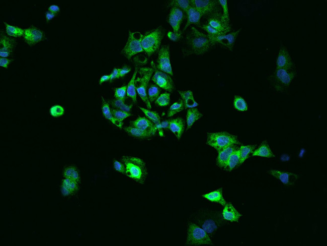 CES1 Antibody in Immunocytochemistry (ICC/IF)