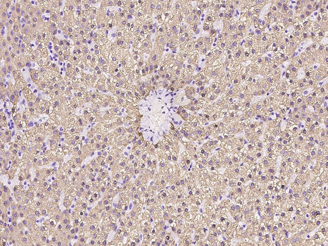 CES1 Antibody in Immunohistochemistry (Paraffin) (IHC (P))