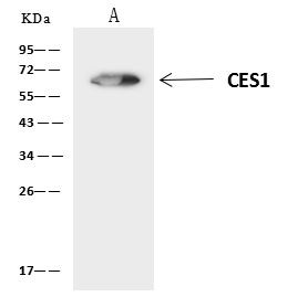 CES1 Antibody in Immunoprecipitation (IP)