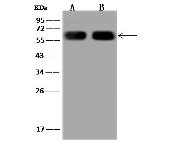 CES1 Antibody in Western Blot (WB)