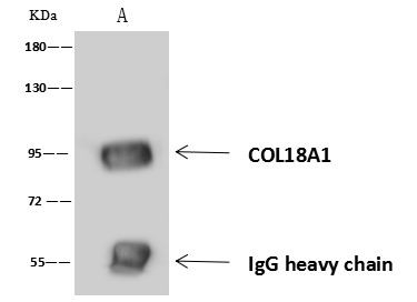 Endostatin Antibody in Immunoprecipitation (IP)