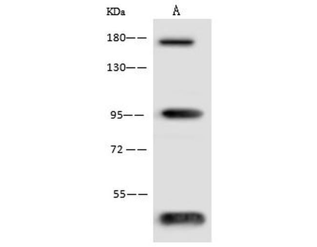 Endostatin Antibody in Western Blot (WB)