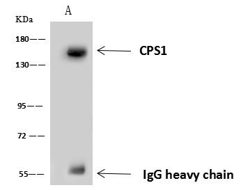 CPS1 Antibody in Immunoprecipitation (IP)