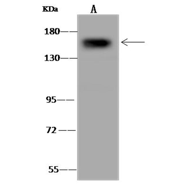 CPS1 Antibody in Western Blot (WB)