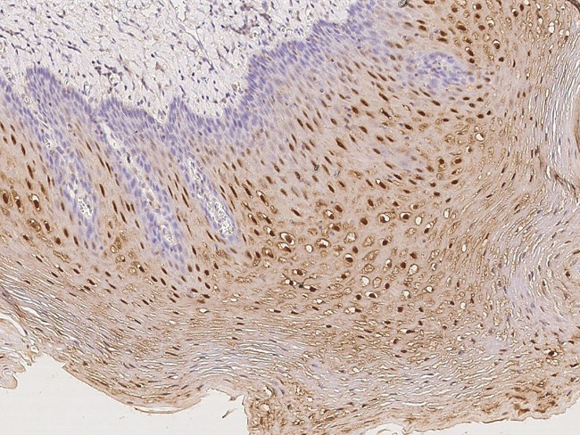 Cystatin B Antibody in Immunohistochemistry (Paraffin) (IHC (P))