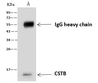 Cystatin B Antibody in Immunoprecipitation (IP)