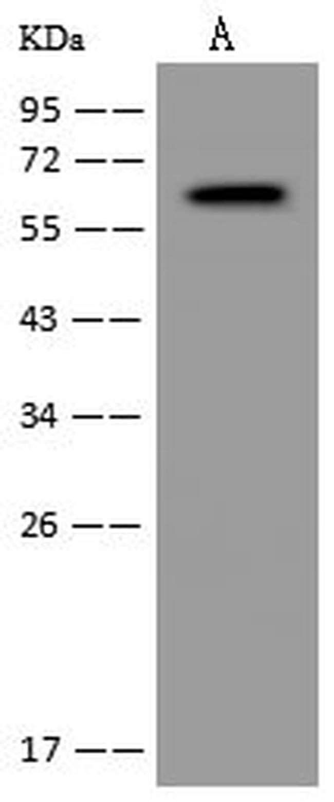 CYP24A1 Antibody in Western Blot (WB)