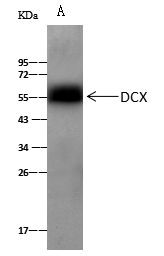 Doublecortin Antibody in Immunoprecipitation (IP)