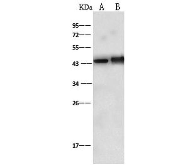 Doublecortin Antibody in Western Blot (WB)