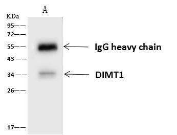 DIMT1 Antibody in Immunoprecipitation (IP)