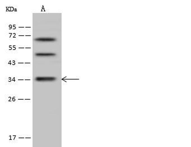 DIMT1 Antibody in Western Blot (WB)