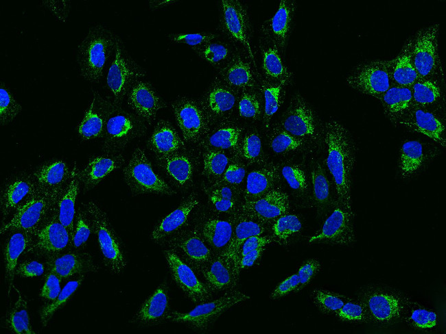 DIXDC1 Antibody in Immunocytochemistry (ICC/IF)