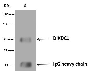 DIXDC1 Antibody in Immunoprecipitation (IP)