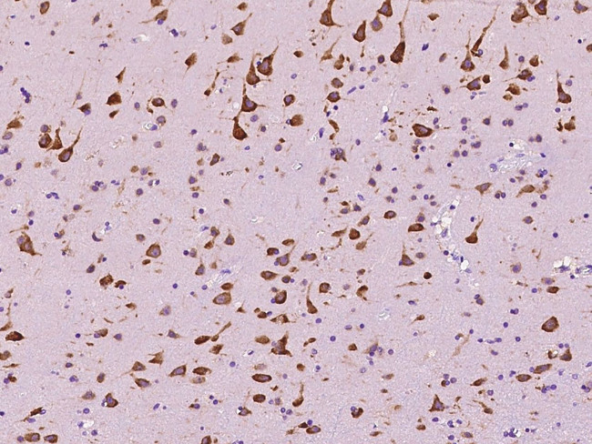 EEF1A2 Antibody in Immunohistochemistry (Paraffin) (IHC (P))