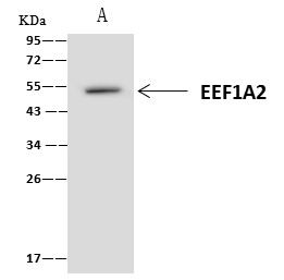 EEF1A2 Antibody in Immunoprecipitation (IP)