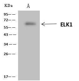 ELK1 Antibody in Immunoprecipitation (IP)