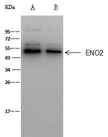 NSE Antibody in Immunoprecipitation (IP)