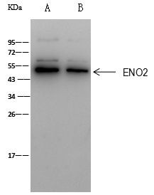 NSE Antibody in Immunoprecipitation (IP)