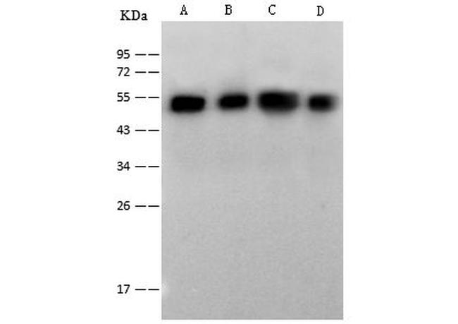 NSE Antibody in Western Blot (WB)