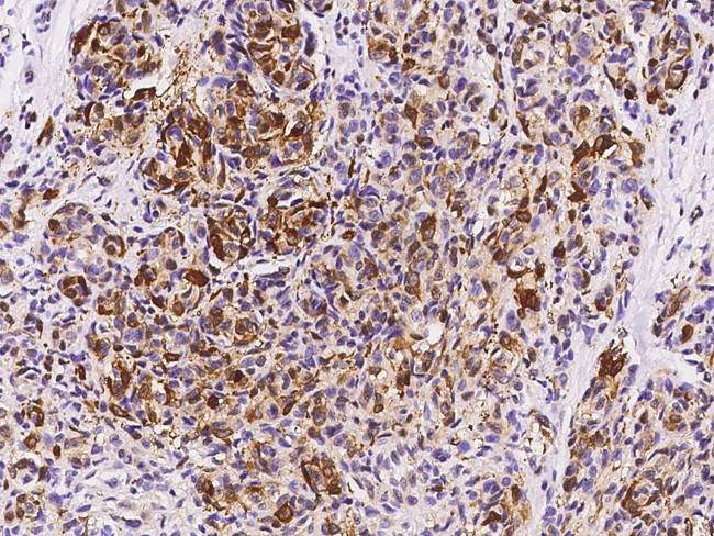 FABP7 Antibody in Immunohistochemistry (Paraffin) (IHC (P))