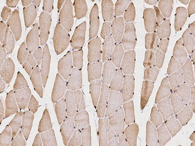 FOXM1 Antibody in Immunohistochemistry (Paraffin) (IHC (P))