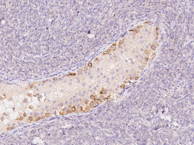 G2E3 Antibody in Immunohistochemistry (Paraffin) (IHC (P))