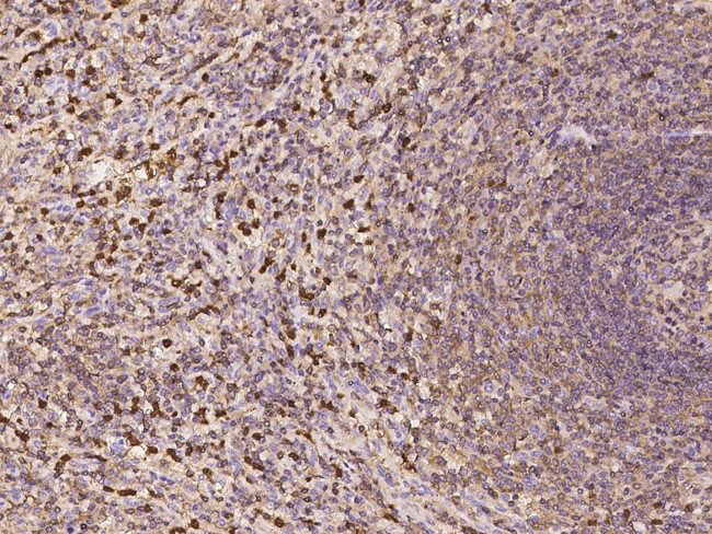 G6PD Antibody in Immunohistochemistry (Paraffin) (IHC (P))